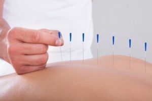 Learn about the interesting link between acupuncture and infertility