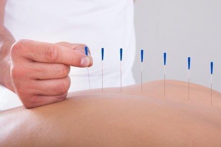 Acupuncture and Infertility